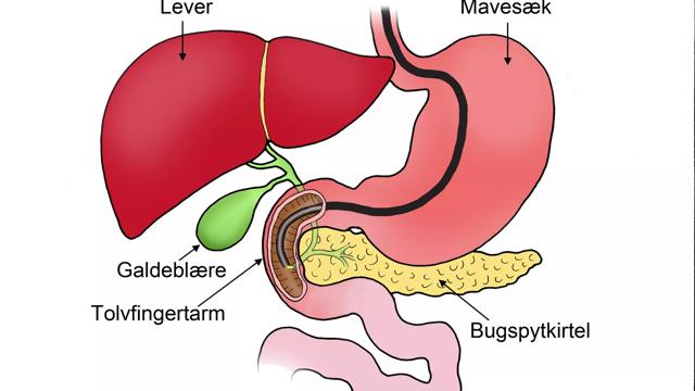 Tegningen viser en ERCP-undersøgelse