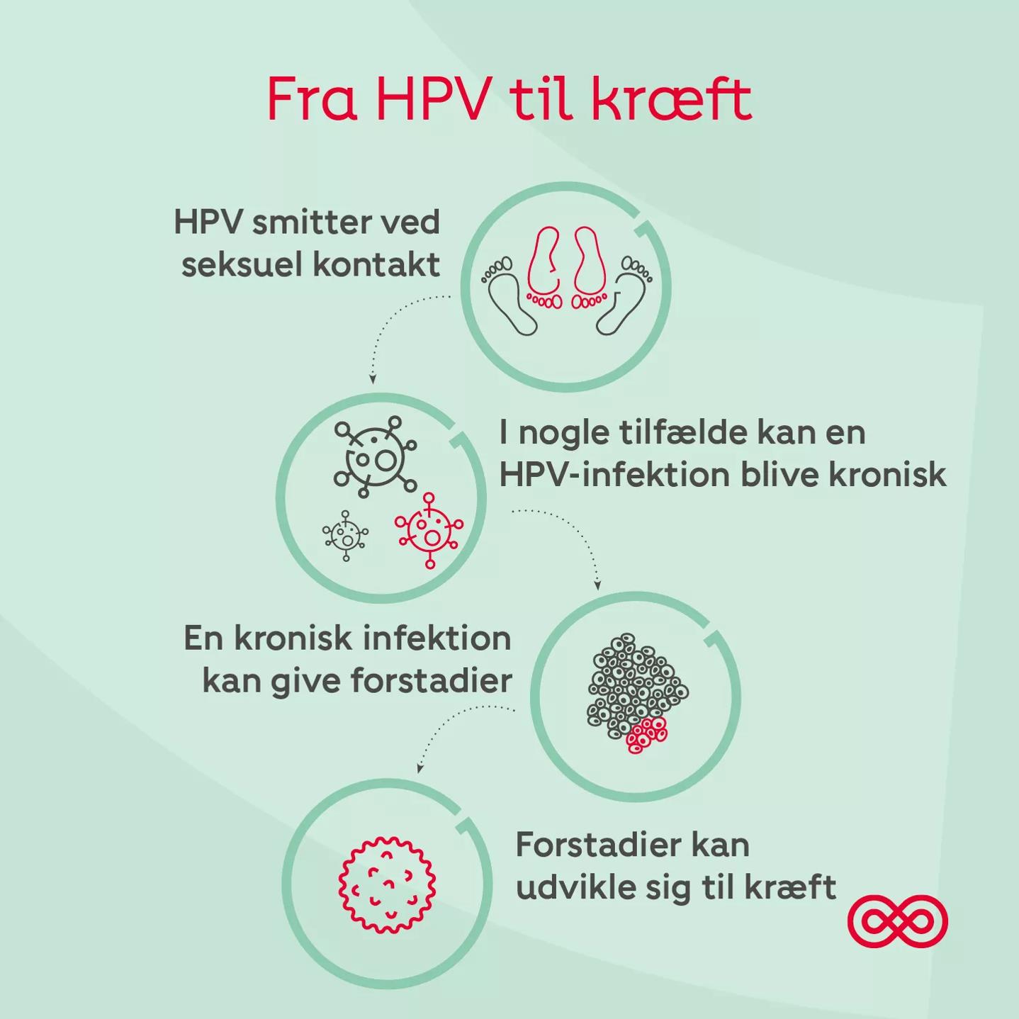 HPV kan i nogle tilfælde udvikle sig til kræft