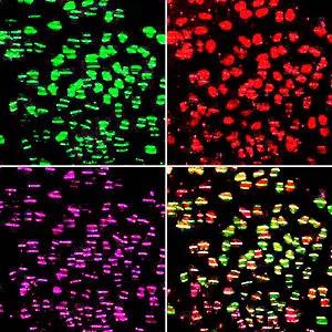 Photo of fluorescent stained cells