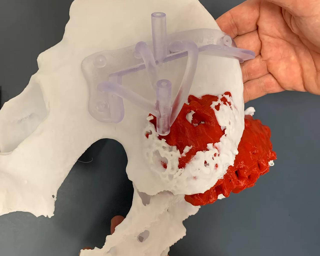 3D-print sarkom