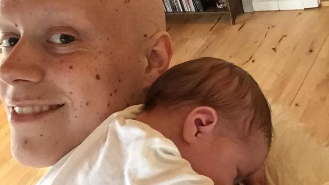mand med baby over skulderen
