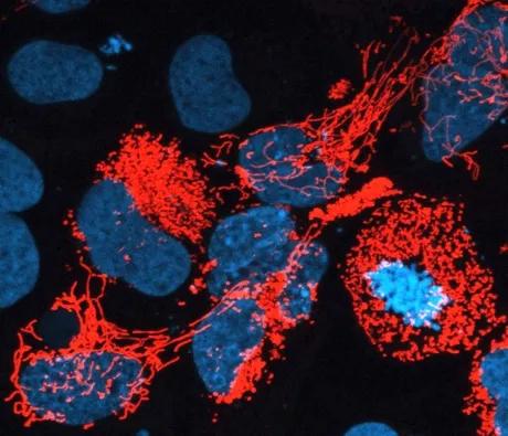 Fluorescent staining of cells