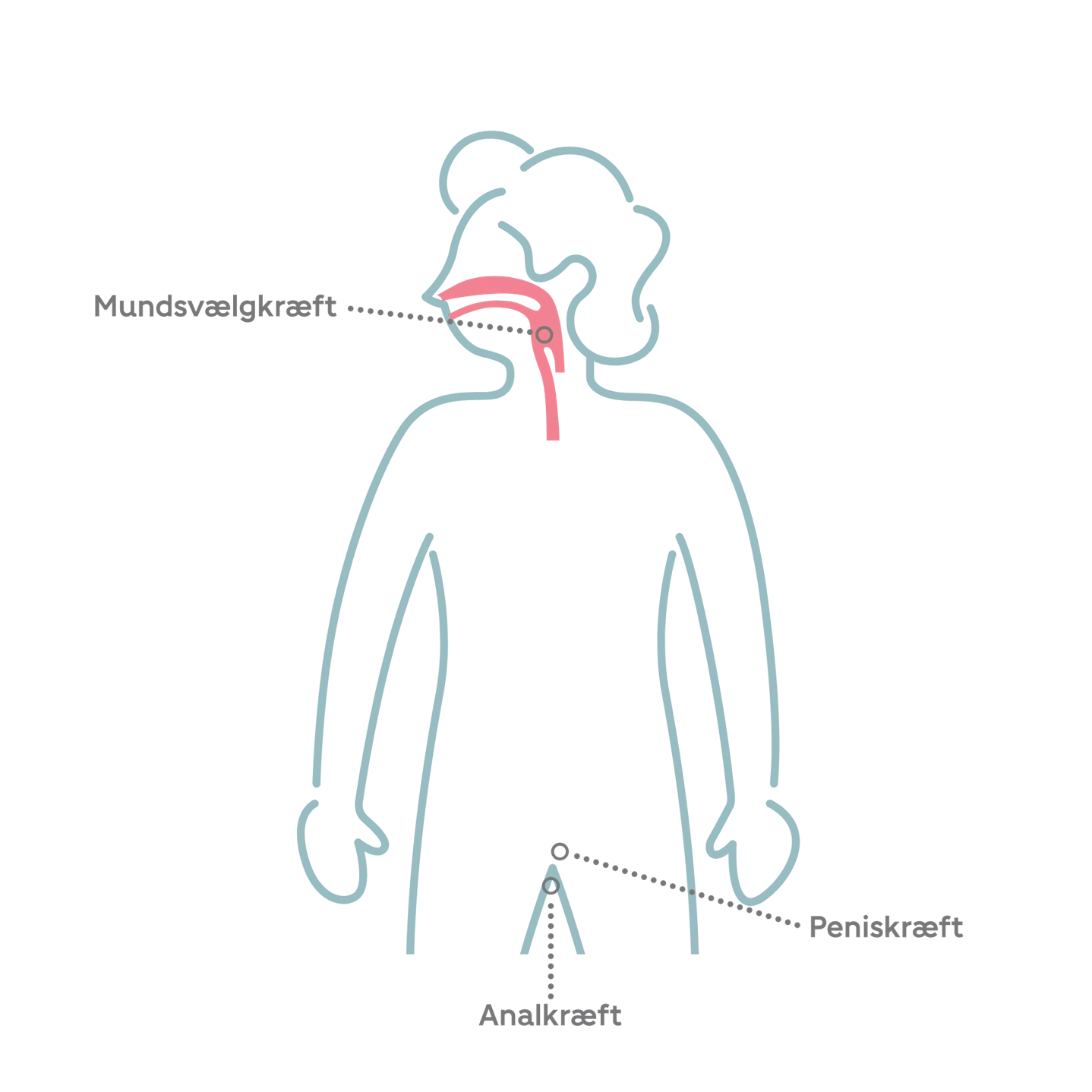 HPV kan give mundsvælgkræft, analkræft og peniskræft hos mænd