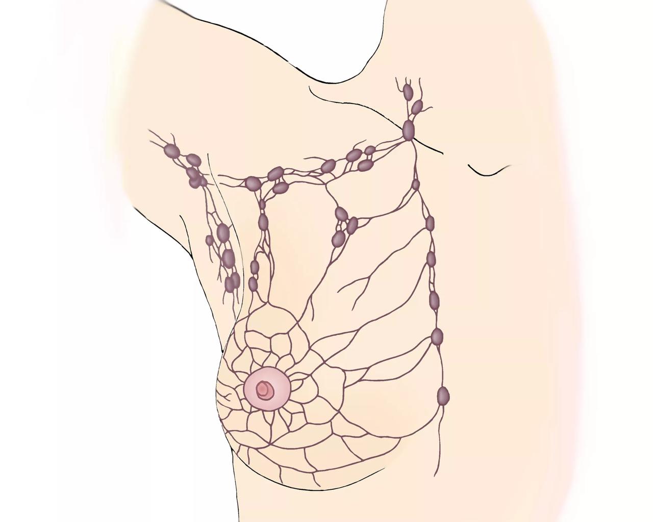 Illustration der viser lymfebanerne omkring brystet