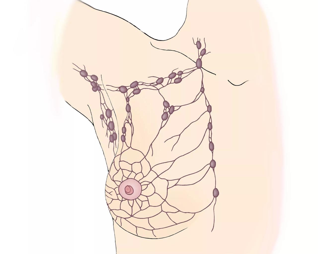 Illustration der viser lymfebanerne omkring brystet