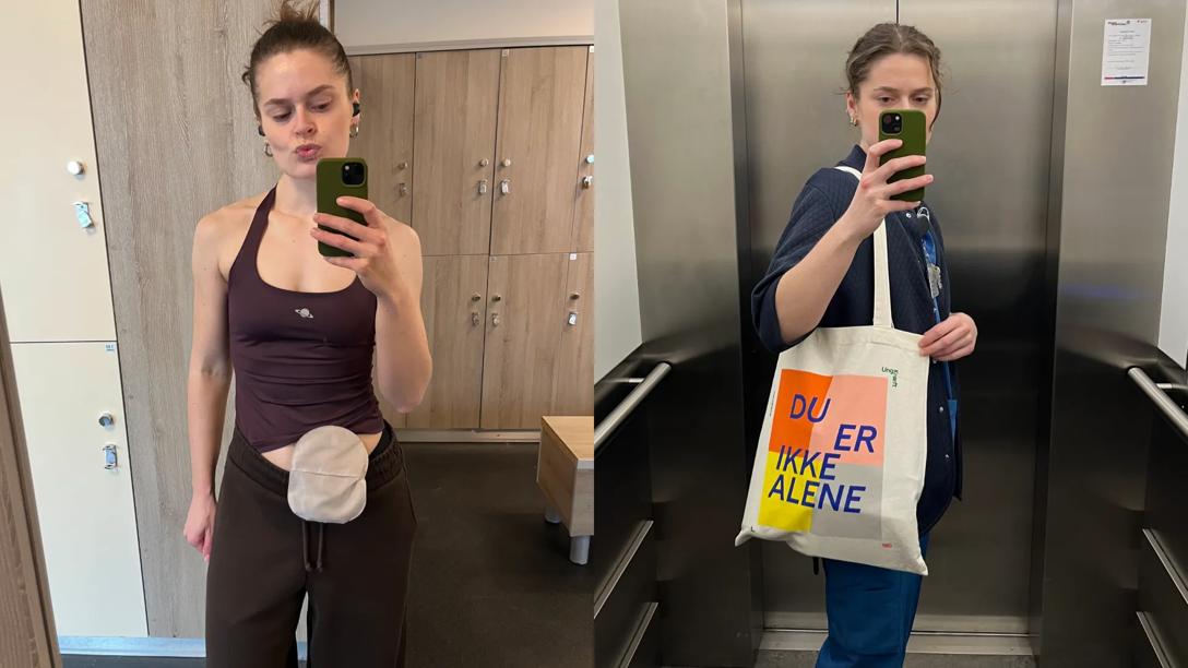 Ung kvinde med stomi