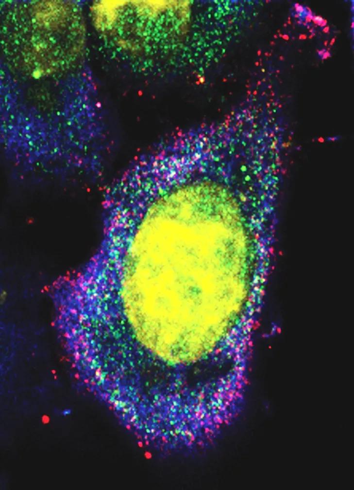 Autophagy within cancer cell