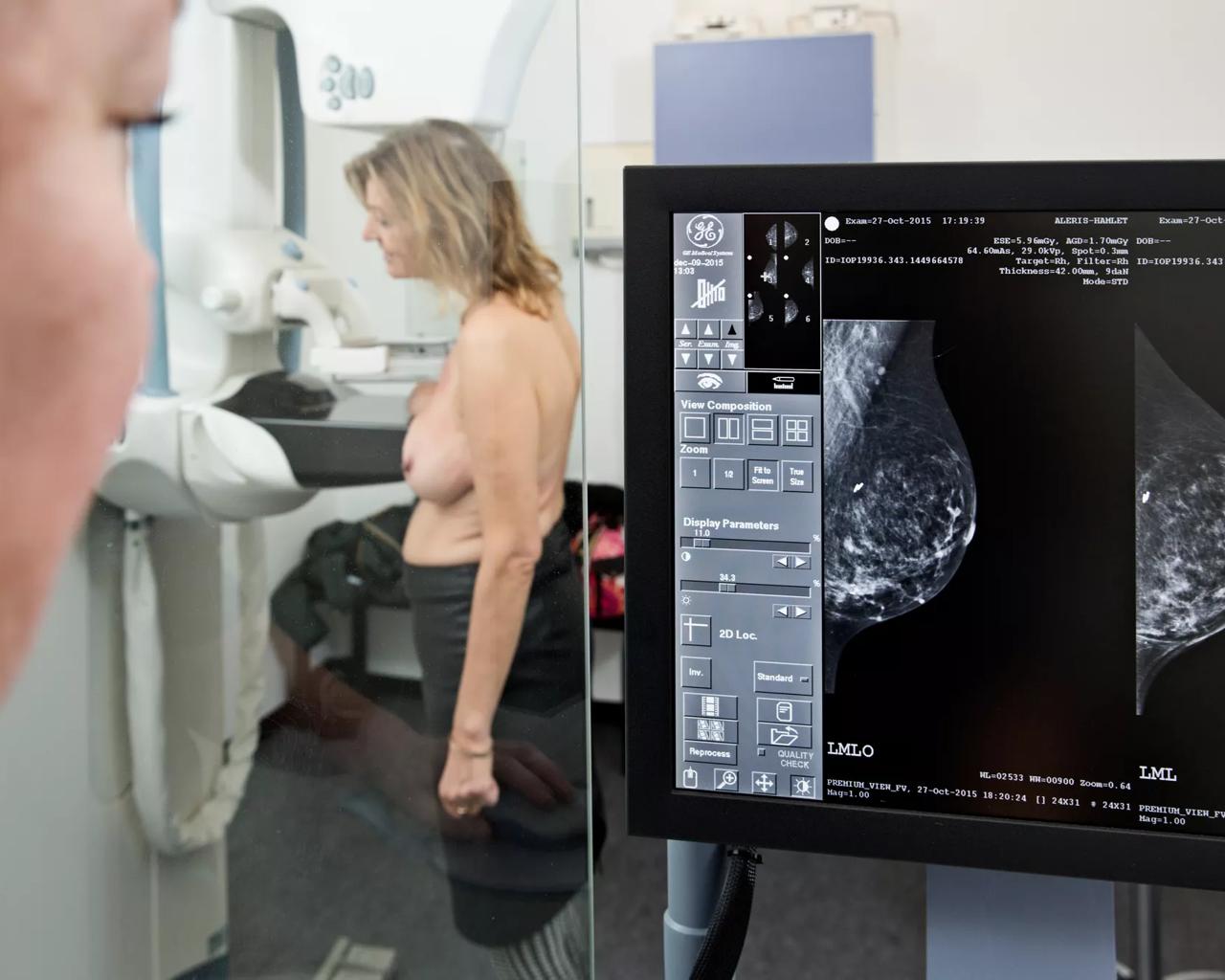Kvinde får lavet mammografi