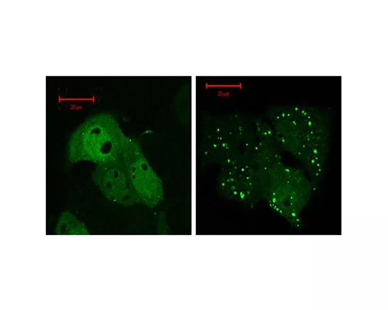 Autophagosomes